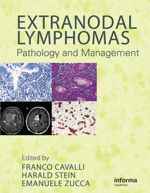 Cover image for book Extranodal Lymphomas