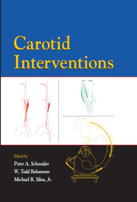 Carotid Interventions 