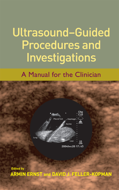 Cover image for book Ultrasound-Guided Procedures and Investigations