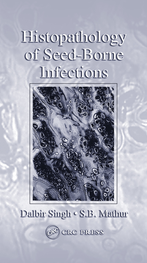 Cover image for book Histopathology of Seed-Borne Infections
