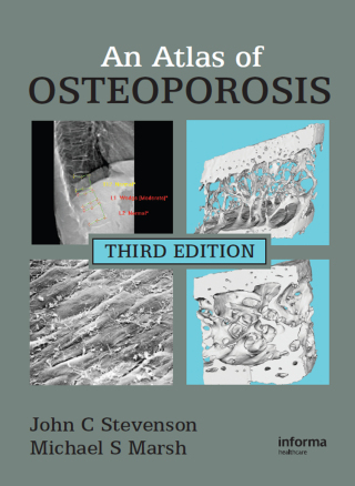 An Atlas of Osteoporosis