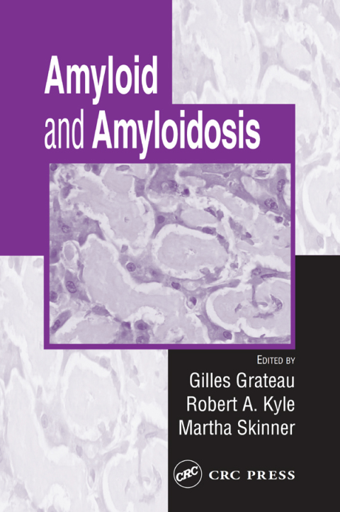 Cover image for book Amyloid and Amyloidosis