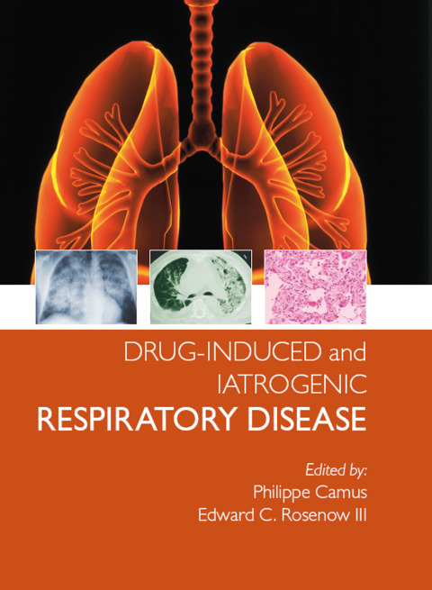 Cover image for book Drug-induced and Iatrogenic Respiratory Disease