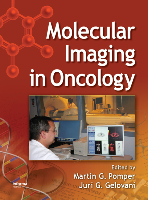 Cover image for book Molecular Imaging in Oncology
