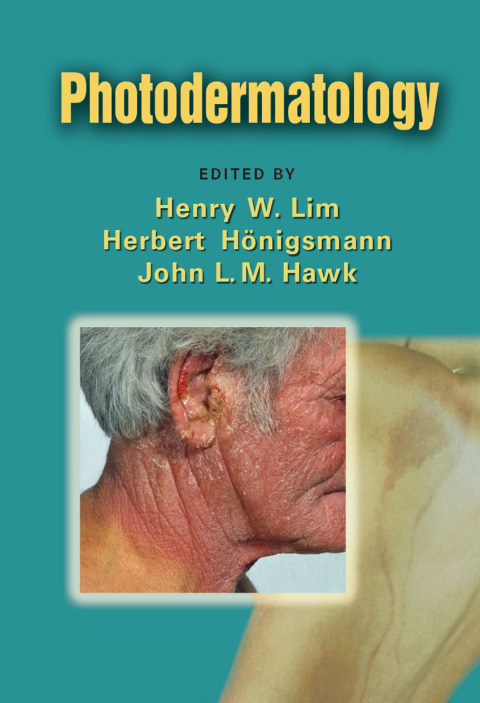 Cover image for book Photodermatology