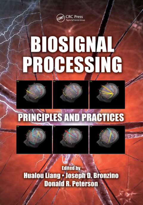 Cover image for book Biosignal Processing