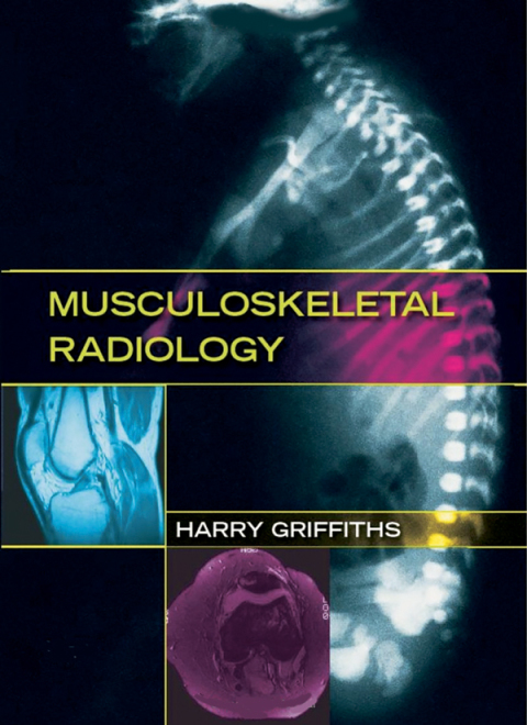 Cover image for book Musculoskeletal Radiology