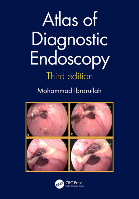 Cover image for book Atlas of Diagnostic Endoscopy, 3E