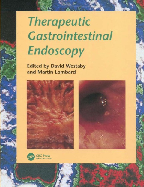 Cover image for book Therapeutic Gastrointestinal Endoscopy