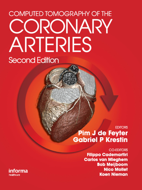 Cover image for book Computed Tomography of the Coronary Arteries