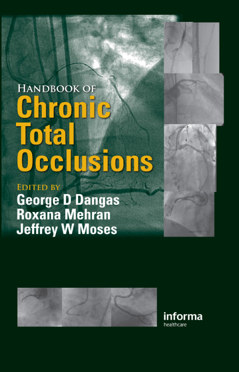Cover image for book Handbook of Chronic Total Occlusions