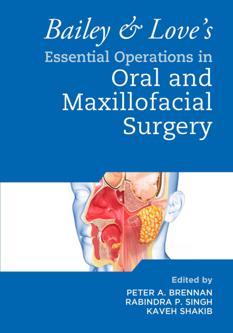 Bailey \u0026 Love's Essential Operations in Oral \u0026 Maxillofacial Surgery 