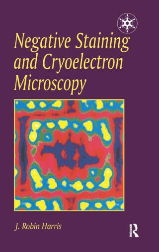 Negative Staining and Cryoelectron Microscopy
