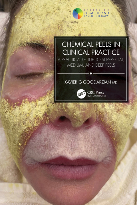 Cover image for book Chemical Peels in Clinical Practice