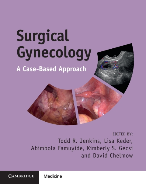 Cover image for book Surgical Gynecology