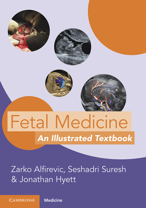 Cover image for book Fetal Medicine