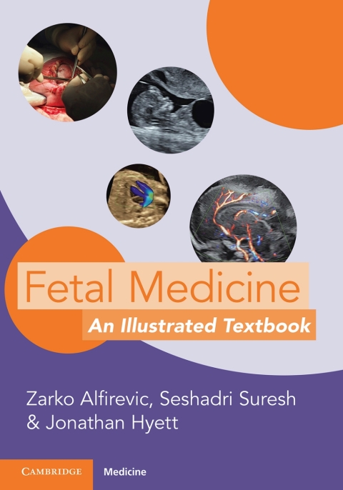 Cover image for book Fetal Medicine