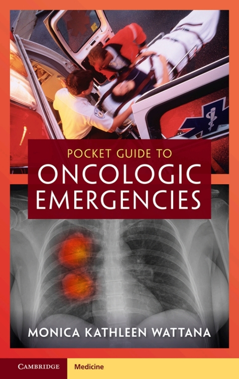 Cover image for book Pocket Guide to Oncologic Emergencies