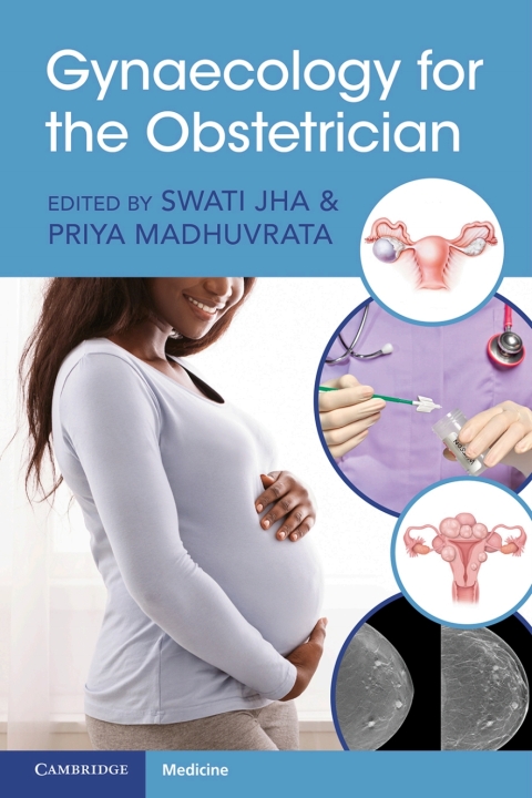 Cover image for book Gynaecology for the Obstetrician