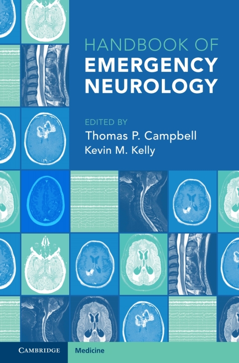 Handbook of Emergency Neurology 