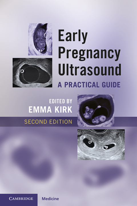 Cover image for book Early Pregnancy Ultrasound