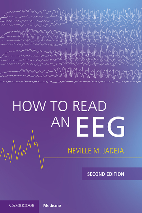 Cover image for book How to Read an EEG