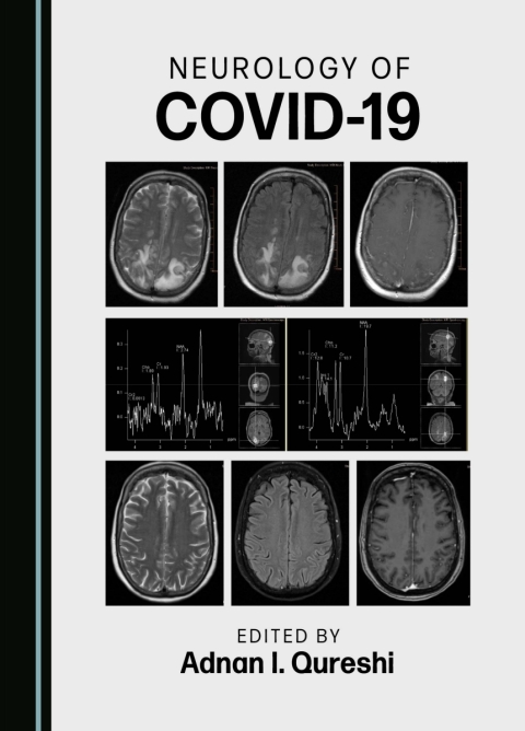 Cover image for book Neurology of COVID-19