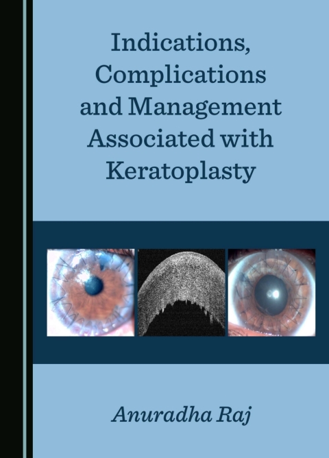 Cover image for book Indications, Complications and Management Associated with Keratoplasty