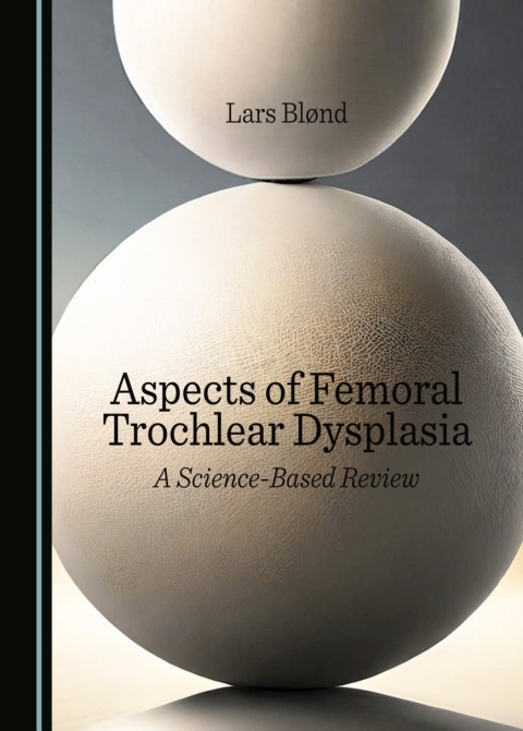 Cover image for book Aspects of Femoral Trochlear Dysplasia
