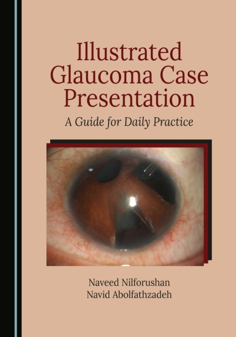 Cover image for book Illustrated Glaucoma Case Presentation