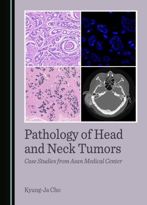 Cover image for book Pathology of Head and Neck Tumors