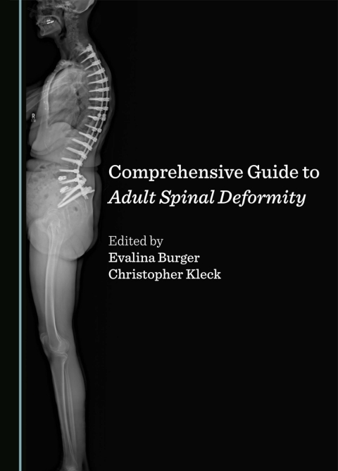 Cover image for book Comprehensive Guide to Adult Spinal Deformity