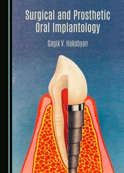 Cover image for book Surgical and Prosthetic Oral Implantology
