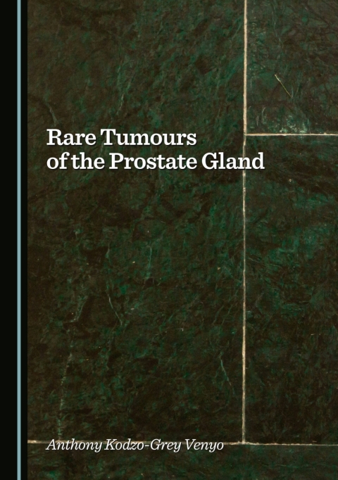 Cover image for book Rare Tumours of the Prostate Gland