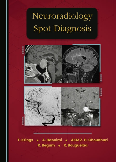 Cover image for book Neuroradiology Spot Diagnosis