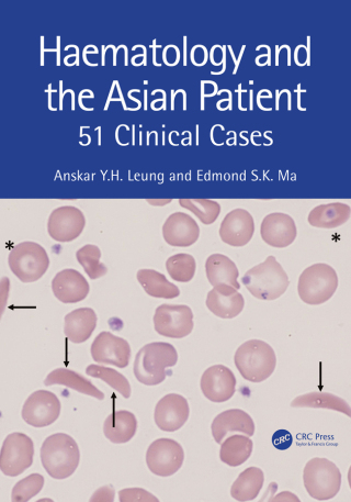 Haematology and the Asian Patient