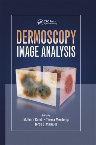Dermoscopy Image Analysis