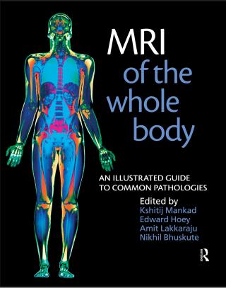 MRI of the Whole Body