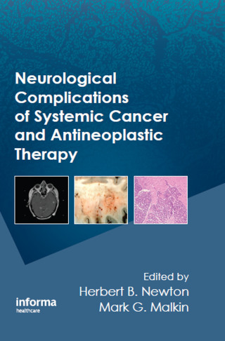 Neurological Complications of Systemic Cancer and Antineoplastic Therapy