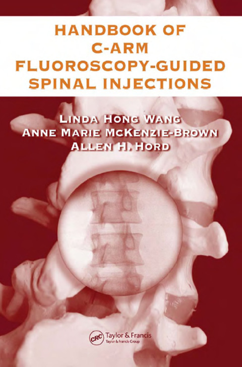 The Handbook of C-Arm Fluoroscopy-Guided Spinal Injections 