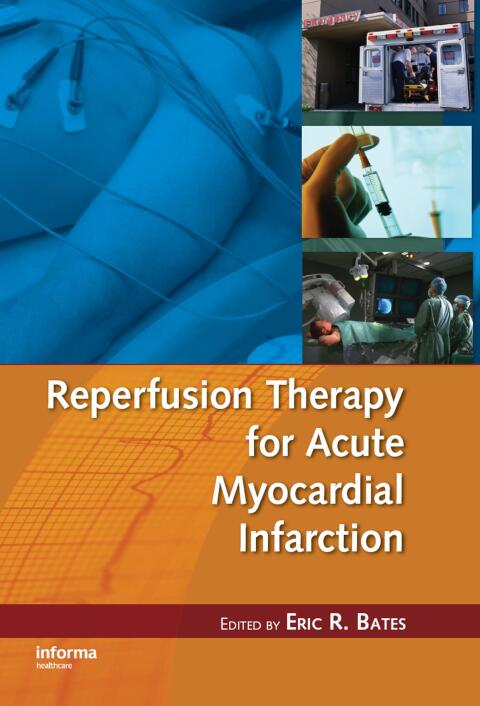 Cover image for book Reperfusion Therapy for Acute Myocardial Infarction
