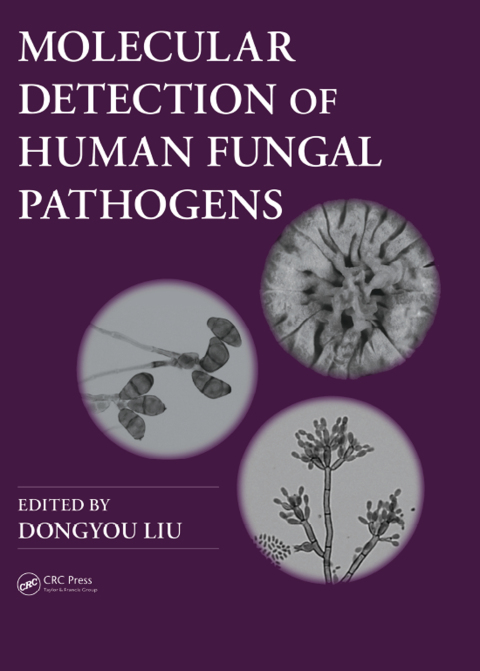 Cover image for book Molecular Detection of Human Fungal Pathogens