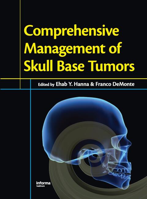 Cover image for book Comprehensive Management of Skull Base Tumors
