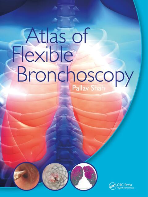 Cover image for book Atlas of Flexible Bronchoscopy