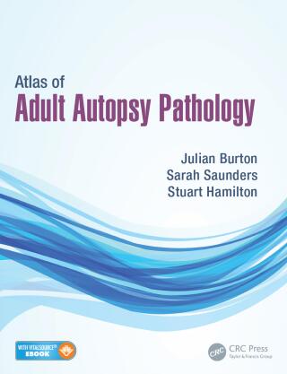 Atlas of Adult Autopsy Pathology
