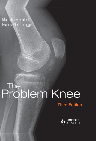 The Problem Knee