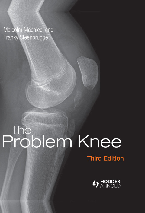 Cover image for book The Problem Knee