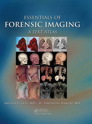 Essentials of Forensic Imaging