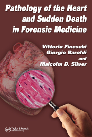 Pathology of the Heart and Sudden Death in Forensic Medicine