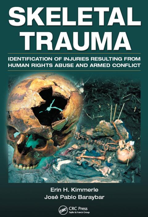 Cover image for book Skeletal Trauma